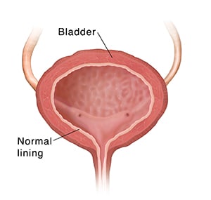 Cross section of bladder, showing normal lining.