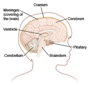 Child's brain, showing cranium, meninges (covering of brain), cerebrum, ventricle, cerebellum, brainstem, and pituitary.
