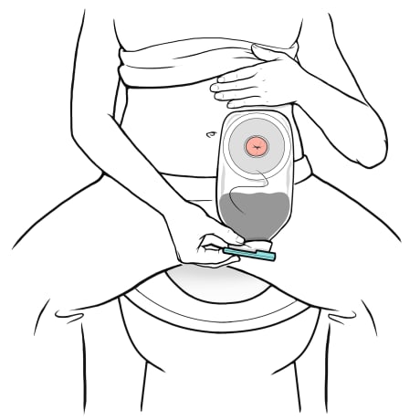 Person sitting at back of toilet with legs spread and one hand lifting shirt up and other hand holding tail and clip of ostomy bag.