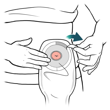 Person peeling back adhesive layer of outer ring of barrier.