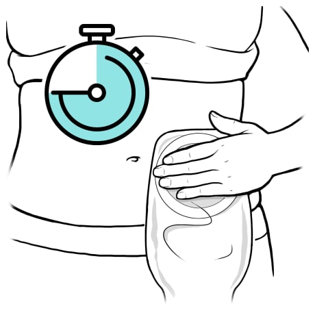 Person placing hand over barrier on front of ostomy bag with stopwatch showing time passing.