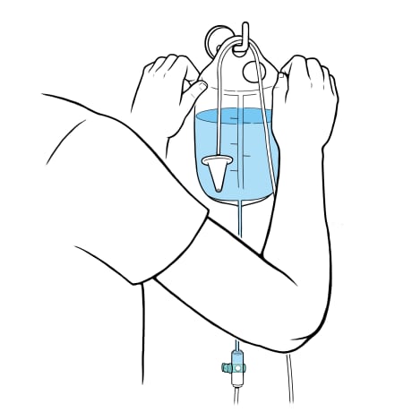 Person hanging water bag and tubing with cone on wall hook.