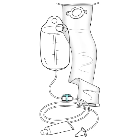 Supplies for stoma irrigation, including irrigation kit with bag, tubing with cone, clamp, sleeve, and lubricant.