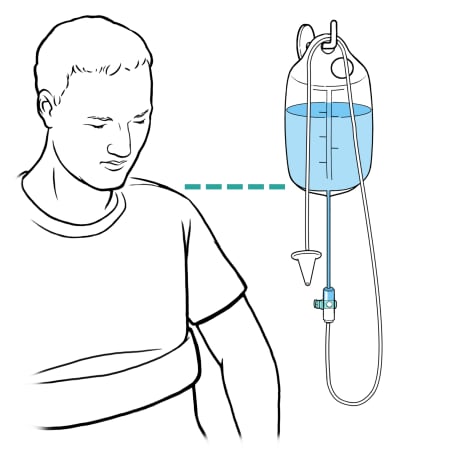 Person sitting next to water bag and tubing with cone on wall hook and line showing bag is level with person’s shoulders.