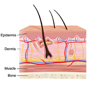 Cross section of skin showing dermis, epidermis, muscle, and bone.