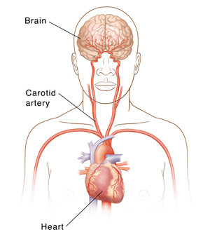 Front view of head and upper body showing carotid arteries, heart, and brain.