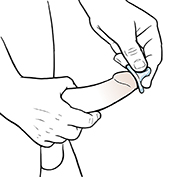 Condom being placed over tip of erect penis.