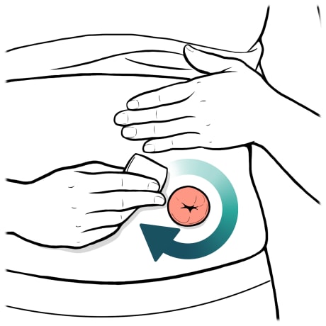 Person holding shirt up with one hand and other hand using wipe on skin around stoma.