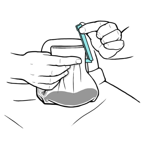Person holding tail of ostomy bag up and opening clip.
