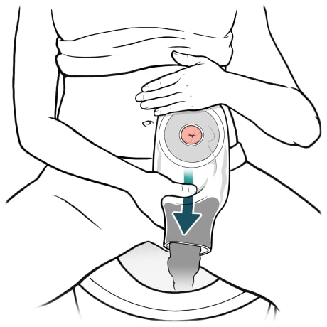 Person on toilet with one hand lifting shirt up, bag tail open over toilet bowl, and other hand sliding down bag with bag contents emptying into toilet.