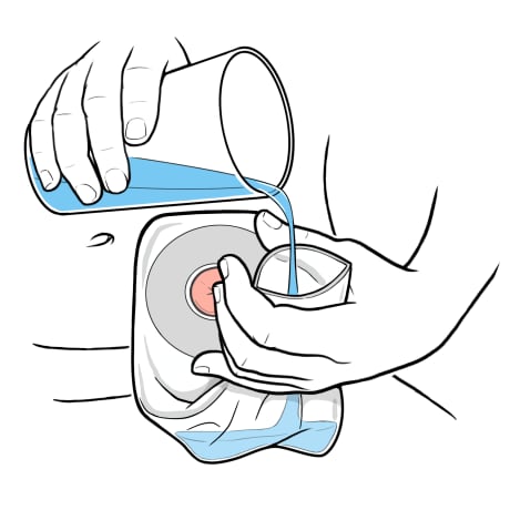 Person holding opening of ostomy bag up with one hand and pouring cup of water into bag.