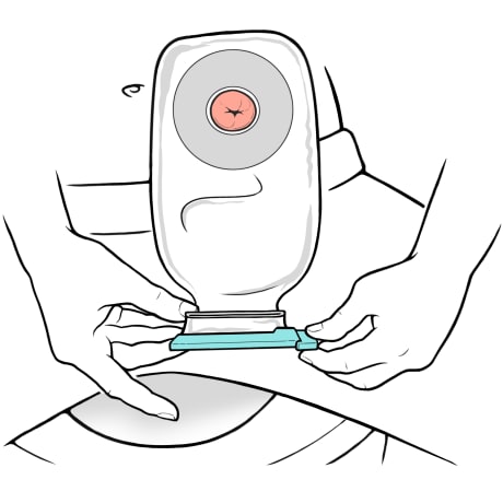 Person folding ostomy bag opening up over clip.