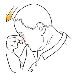 Man leaning head forward and pinching nose.