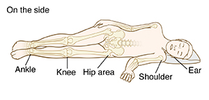 Person lying on side, showing areas where pressure injuries happen, at the ear, shoulder, hip area, knees, and ankle.