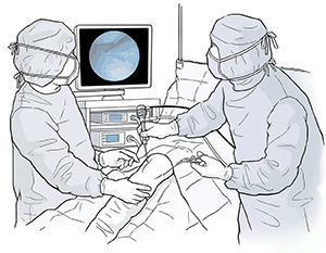 Two health care providers performing knee arthroscopy on patient in operating room.