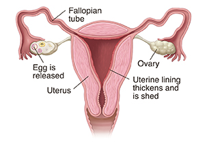 Cross section front view of uterus, uterine lining, fallopian tubes, ovaries, and egg released into fallopian tube.