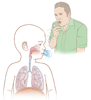 Man coughing and spreading droplets into air and child breathing in droplets.