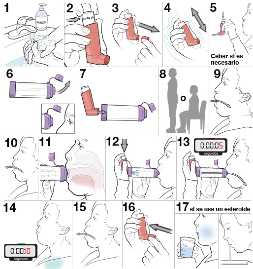 17 pasos para usar un inhalador de dosis medida con espaciador