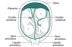 Dentro del útero, hay una placenta con dos sacos amnióticos. Cada saco tiene su propio líquido amniótico y feto en su interior.