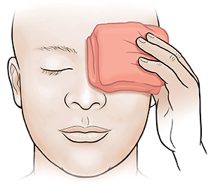 Adult holding warm compress on eye.